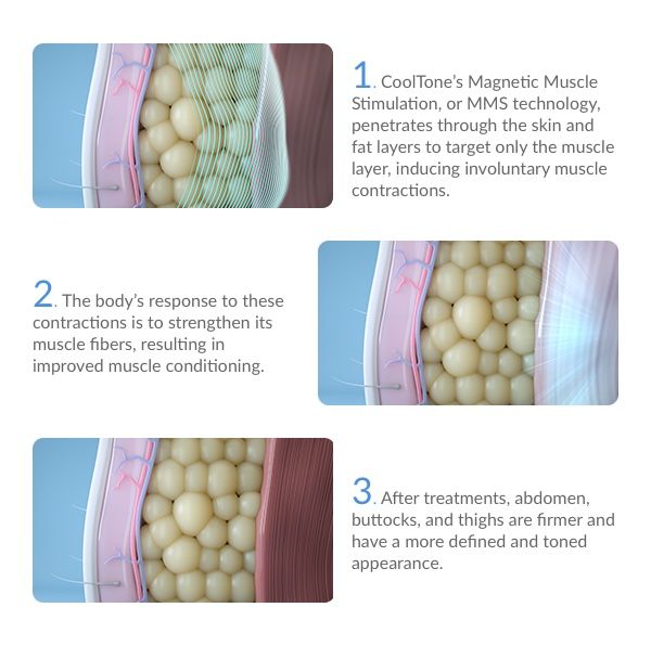 Illustration of CoolTone's effects